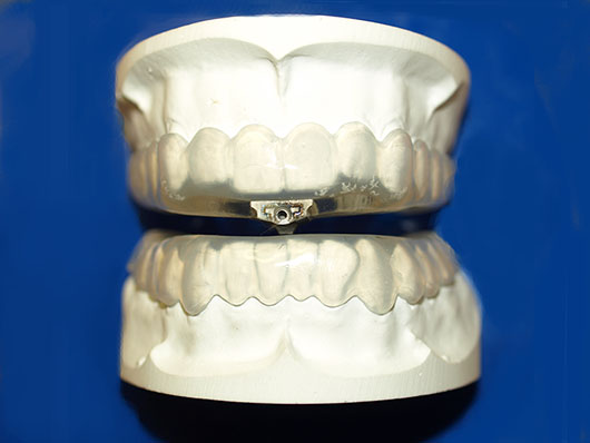 Kundenbild groß 3 Mirwald Andreas, Fachzahnarzt für Oralchirurgie